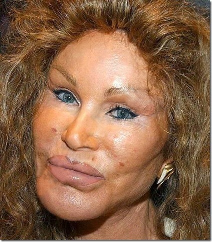 jocelyn-wildenstein-2--218b2c8.jpg